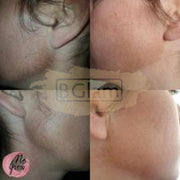 No Grow Female Facial Hair Remover & Growth Inhibitor 90Ml