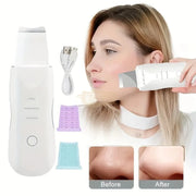 USB Rechargeable Ultrasonic Skin Scrubber Blackhead Remover | Pore Cleansing Facial Device for Clear Skin Skin Care