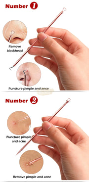4 pcs Blackhead Remover/Pimple Comedone Extractor Tool Set Acne Needle