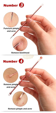 4 pcs Blackhead Remover/Pimple Comedone Extractor Tool Set Acne Needle