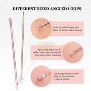 4 pcs Blackhead Remover/Pimple Comedone Extractor Tool Set Acne Needle