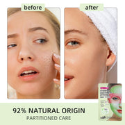 MONDSUB Ceramide & Niacinamide Hydrogel Face Mask 28g | Barrier Repair & Brightening
