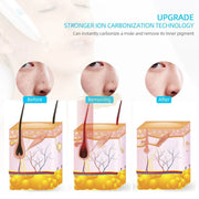 9-Level Beauty Mole Removal Pen with LED Display Skin Care Machine