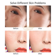 9-Level Beauty Mole Removal Pen with LED Display Skin Care Machine