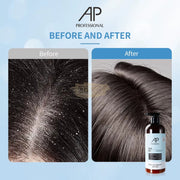 AP Professional Anti-dandruffand & Anti-itching Shampoo | 500ml Hair Shampoo