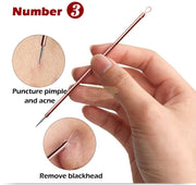 Blackhead Remover/Pimple Comedone Extractor | Pointed Silver Tip/Squeezing Loop - Rose Gold Skin Care Tools