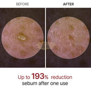 Dr.Melaxin Peel Shot Exfoliating Black Rice Ampoule | 80ml Rice Water Peel Ampoule