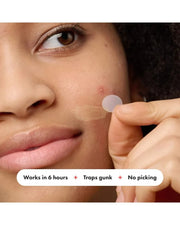 Hero Mighty Patch The Original Anti-Acne