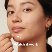 Hero Mighty Patch The Original Anti-Acne