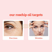 Inatur 100% Pure Cold-Pressed Rosehip Oil 30ml Oil