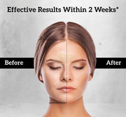 Inatur Charcoal Face Scrub 100g Face Scrub