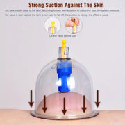 KYF 32 Pcs Cupping Therapy Set cupping kit