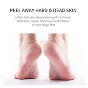 Foot Peel Mask | Exfoliating | Lavendar (5 pairs) Foot Mask
