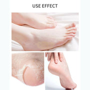 Foot Peel Mask | Exfoliating | Lavendar (5 pairs) Foot Mask