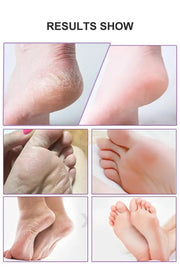 Foot Peel Mask | Exfoliating | Lavendar (5 pairs) Foot Mask