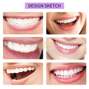 Lunoon Tooth Gem Kit Tooth Gem