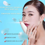 USB Rechargeable Blackhead Remover | Nose Pore Cleaner