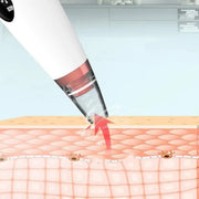 USB Rechargeable Blackhead Remover | Nose Pore Cleaner