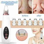 USB Rechargeable Blackhead Remover | Nose Pore Cleaner