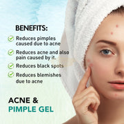 Mitvana Acne & Pimple Gel 30g Anti-Acne