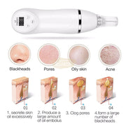 Portable Diamond Dermabrasion Skin Peeling Beauty Device Beauty Tools
