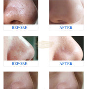 Portable Diamond Dermabrasion Skin Peeling Beauty Device Beauty Tools