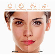 Portable High Frequency Facial Skin Therapy Wand LZ-006A Skin Care Machine