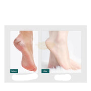 Pro Spa Foot File with Disposable Grit Strips Foot Care
