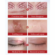 Sadoer Repair Scar Cream 20g Repairing Cream