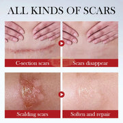 Sadoer Repair Scar Serum 40 ml Scar Remover