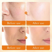 Sadoer Vitamin C Antioxidant Repair Whitening Serum Face Serum
