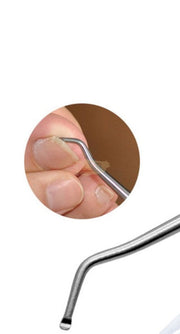 Stainless Steel Ingrown Toenail Lifter & Cleaner Nail Care Tool 16.5cm Manicure Tools