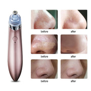 USB Rechargeable Blackhead Remover | Pore Cleaner Skin Care Tools