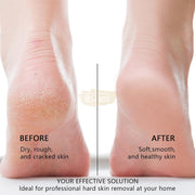 USB Rechargeable Electric Foot File Callus Remover Foot care