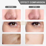 USB Rechargeable Ultrasonic Skin Scrubber Blackhead Remover | Pore Cleansing Facial Device for Clear Skin Skin Care