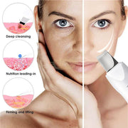 USB Rechargeable Ultrasonic Skin Scrubber Blackhead Remover | Pore Cleansing Facial Device for Clear Skin Skin Care