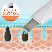 USB Rechargeable Ultrasonic Skin Scrubber Blackhead Remover | Pore Cleansing Facial Device for Clear Skin Skin Care