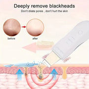USB Rechargeable Ultrasonic Skin Scrubber Blackhead Remover | Pore Cleansing Facial Device for Clear Skin Skin Care