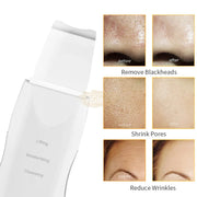 USB Rechargeable Ultrasonic Skin Scrubber Blackhead Remover | Pore Cleansing Facial Device for Clear Skin Skin Care