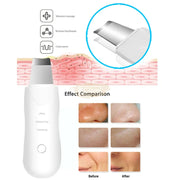 USB Rechargeable Ultrasonic Skin Scrubber Blackhead Remover | Pore Cleansing Facial Device for Clear Skin Skin Care