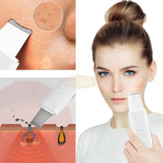 USB Rechargeable Ultrasonic Skin Scrubber Blackhead Remover | Pore Cleansing Facial Device for Clear Skin Skin Care